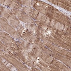 Anti-KLHL34 Antibody