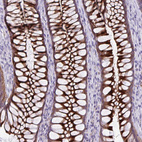 Anti-PRSS45 Antibody