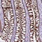 Anti-PRSS45 Antibody