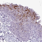 Immunohistochemical staining of human urinary bladder shows moderate cytoplasmic positivity in a subset of urothelial cells.