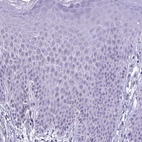 Immunohistochemical staining of human skin shows no positivity in squamous epithelial cells as expected.