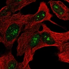 Anti-ZNF790 Antibody