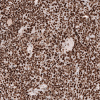 Anti-MSH2 Antibody