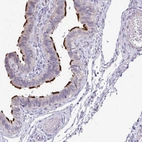 Anti-MROH8 Antibody