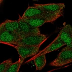 Immunofluorescent staining of human cell line SH-SY5Y shows localization to nucleus & cytosol.
