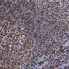 Anti-HIST1H1B Antibody