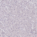 Anti-C8orf22 Antibody