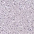 Immunohistochemical staining of human liver shows no positivity in hepatocytes as expected.