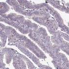 Immunohistochemical staining of human fallopian tube shows no positivity in glandular cells as expected.