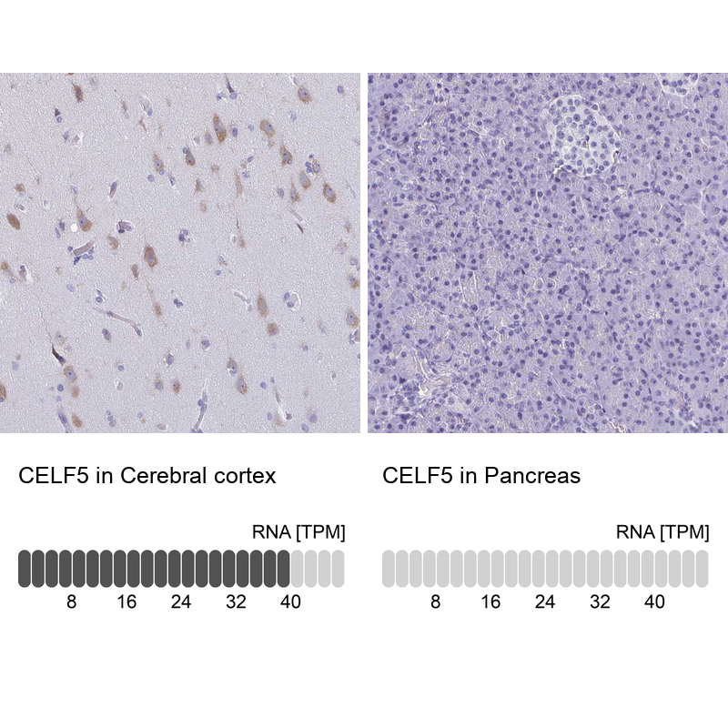 Anti-CELF5 Antibody