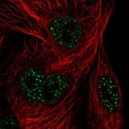 Anti-FAM71A Antibody