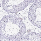 Immunohistochemical staining of human testis shows low expression as expected.