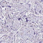 Anti-FAM162B Antibody