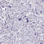Immunohistochemical staining of human placenta shows high expression.