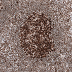 Immunohistochemical staining of human lymph node shows strong nuclear positivity in germinal center cells.