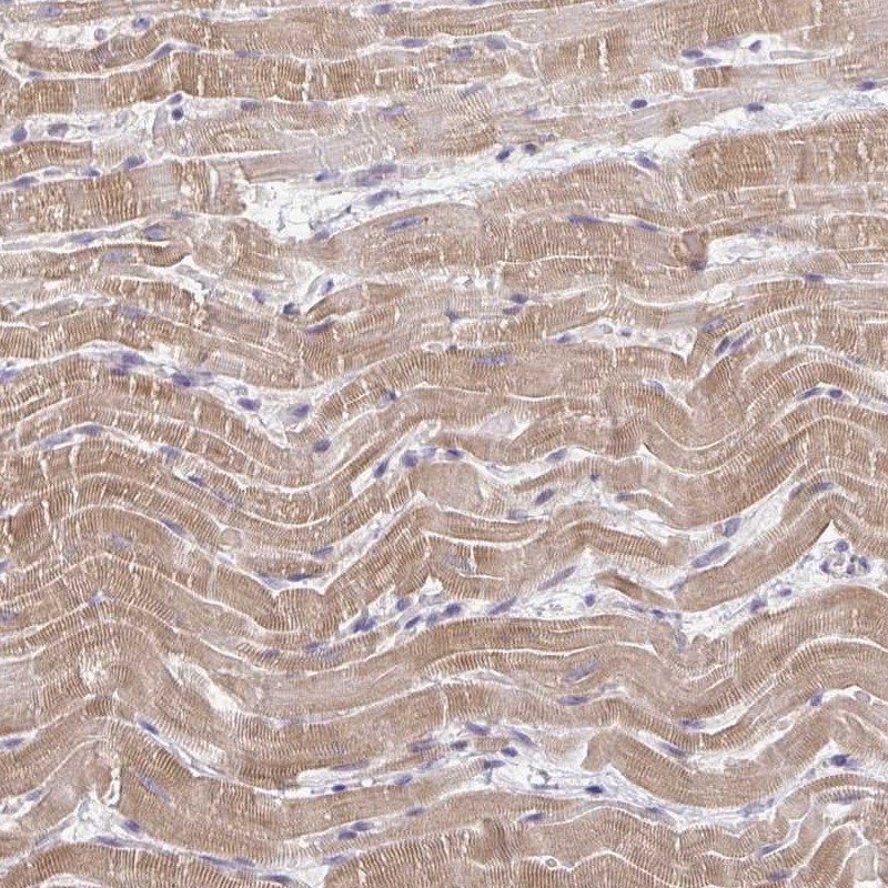 Anti-MCRIP2 Antibody