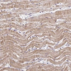 Anti-MCRIP2 Antibody