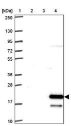Lane 1: Marker [kDa] 250, 130, 95, 72, 55, 36, 28, 17, 10_br/_Lane 2: Human cell line RT-4_br/_Lane 3: Human cell line U-251MG sp_br/_Lane 4: Human plasma (IgG/HSA depleted)