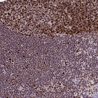 Anti-DUT Antibody