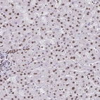 Immunohistochemical staining of human liver shows low expression as expected.