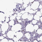 Anti-SATL1 Antibody