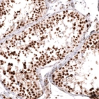 Immunohistochemical staining of human testis shows strong nuclear positivity in cells in seminiferous ducts.