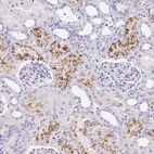 Anti-C4orf17 Antibody