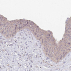 Anti-IFI44L Antibody