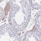 Immunohistochemical staining of human testis shows moderate cytoplasmic positivity in Leydig cells.