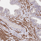 Immunohistochemical staining of human prostate shows strong cytoplasmic positivity in smooth muscle cells.