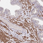 Immunohistochemical staining of human prostate shows strong cytoplasmic positivity in smooth muscle cells.