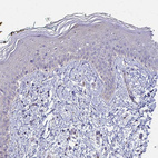 Immunohistochemical staining of human skin shows no positivity in squamous epithelial cells as expected.