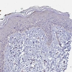 Immunohistochemical staining of human skin shows no positivity in squamous epithelial cells as expected.