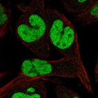 Anti-TCEAL1 Antibody