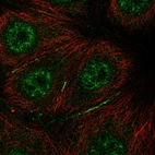 Anti-BRK1 Antibody