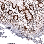 Immunohistochemical staining of human small intestine shows strong nuclear positivity in glandular cells.