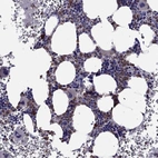 Immunohistochemical staining of human bone marrow shows high expression.