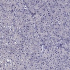 Immunohistochemical staining of human pancreas shows low expression as expected.