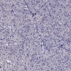 Anti-RFLNB Antibody