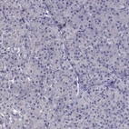 Immunohistochemical staining of human pancreas shows low expression as expected.
