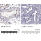 Anti-C7orf61 Antibody