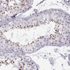 Immunohistochemical staining of human testis shows high expression.