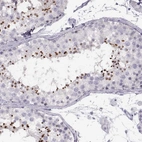 Immunohistochemical staining of human testis shows high expression.