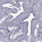 Anti-C7orf61 Antibody