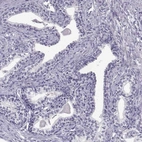 Immunohistochemical staining of human prostate shows low expression as expected.