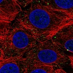 Immunofluorescent staining of human cell line MCF7 shows localization to vesicles.