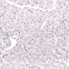 Anti-MSH2 Antibody