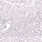 Immunohistochemical staining of human liver shows no nuclear positivity in hepatocytes as expected.
