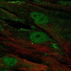 Anti-CENPJ Antibody