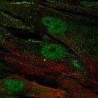 Anti-CENPJ Antibody